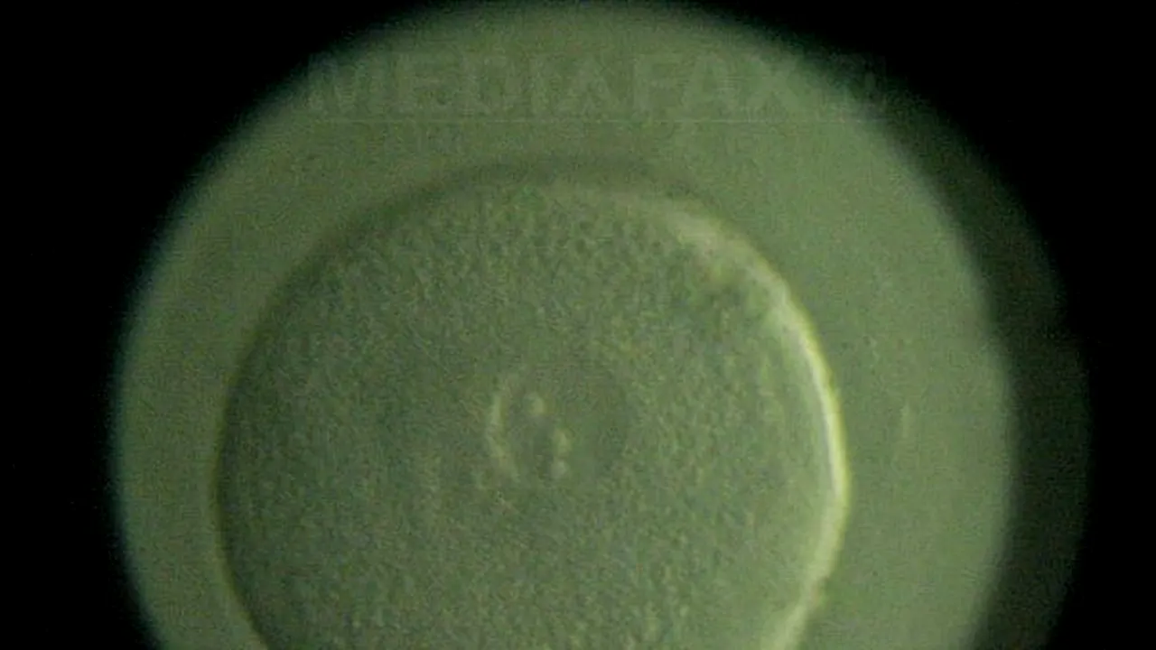 În România se fac anual de 10 ori mai puţine fertilizări in vitro decât în Europa de Vest