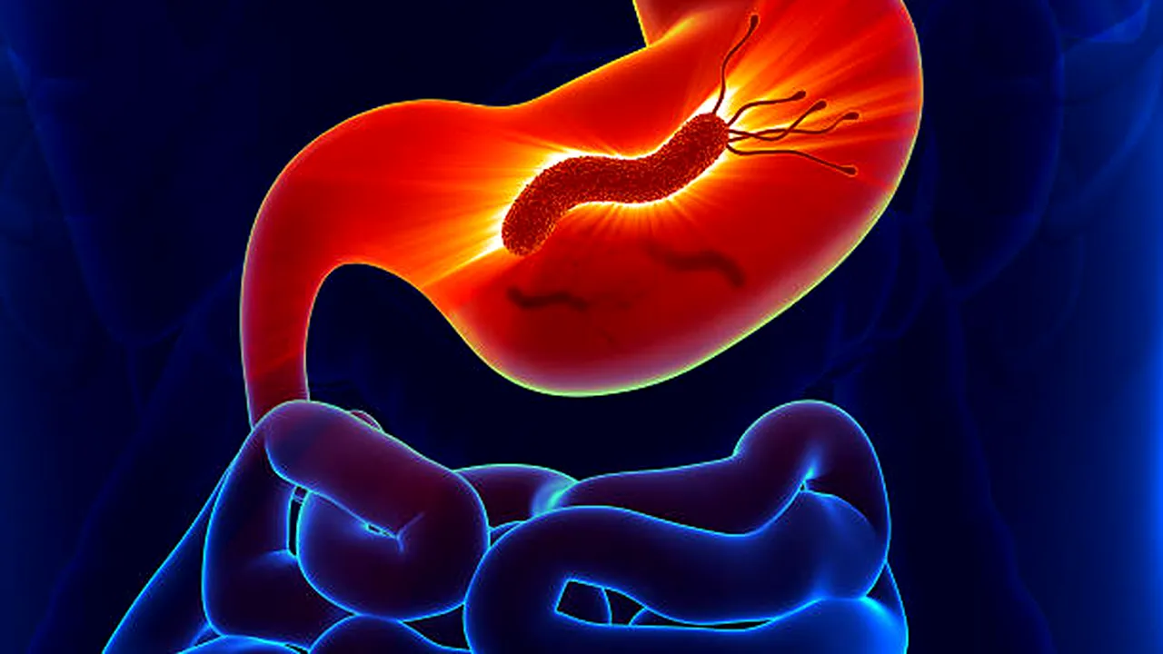 O bacterie din copilărie ar putea cauza 15 milioane de cazuri de cancer
