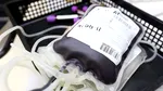 Organul universal / Cercetătorii au reușit să modifice grupa sanguină a unui organ și astfel au extins șansele la transplant ale pacienților cu grupa 0