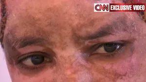 Imagini şocante: Bona copiilor unuia dintre fiii lui Kadhafi, mutilată de soţia acestuia - VIDEO