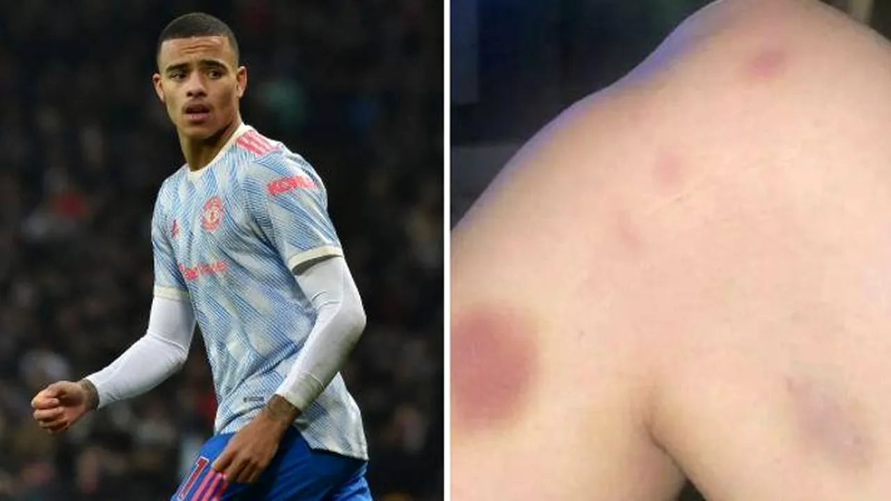 UPDATE / Fotbalistul Mason Greenwood a fost arestat. Iubita lui a publicat fotografii despre agresiunile comise asupra sa de fotbalistul echipei Manchester United
