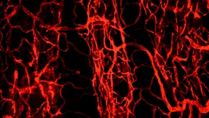 Coronavirus deteriorează pereţii interiori ai vaselor de sânge