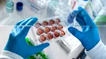 Ţările din Europa în care se fac cele mai multe transplanturi de celule stem. Pe ce loc e România?