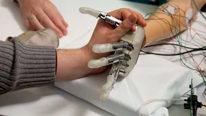 Premieră mondială: un bărbat şi-a regăsit simţul tactil, cu ajutorul unei proteze inovatoare - FOTO, VIDEO