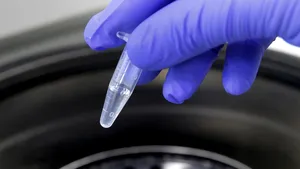 Noi studii sugerează o nouă cale pentru inversarea diabetului de tip 2 şi a fibrozei hepatice