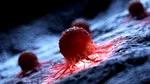În SUA, a fost creat un vaccin personalizat împotriva cancerului cerebral, anunță Universitatea Washington