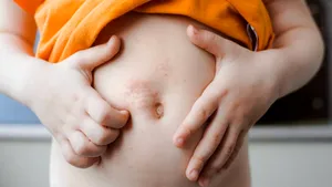 Bolile perioadei victoriene reapar în Marea Britanie 