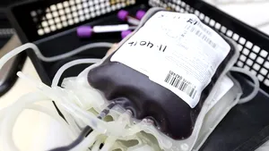 Organul universal / Cercetătorii au reușit să modifice grupa sanguină a unui organ și astfel au extins șansele la transplant ale pacienților cu grupa 0