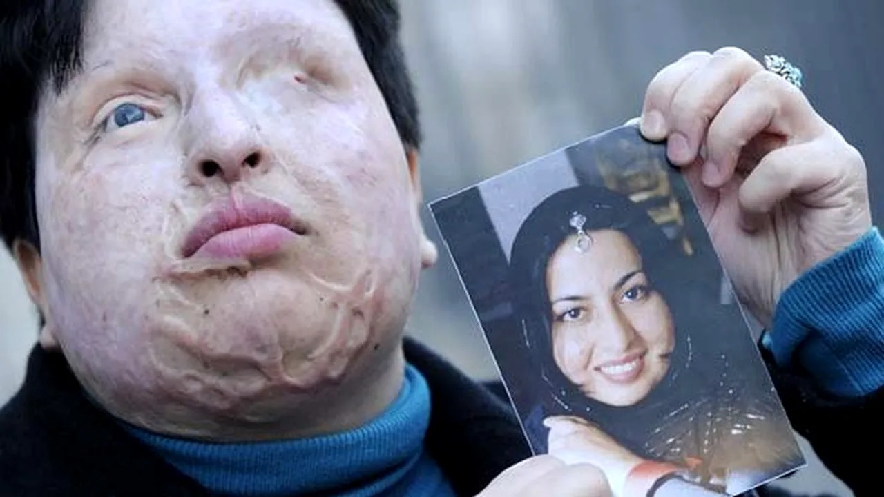 Sentinţă şocantă în Iran: O femeie îi poate turna acid în ochi bărbatului care a orbit-o