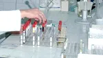 Analizele obişnuite de sânge pot prezice dacă pacientul va răspunde la imunoterapie