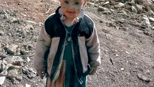 Afganii îşi sedează copiii înfometaţi. ONU vorbeşte despre o 