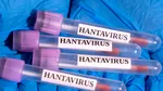 O însoțitoare de bord, internată în Amsterdam după ce a intrat în contact cu o victimă a focarului de hantavirus de pe vasul Hondius