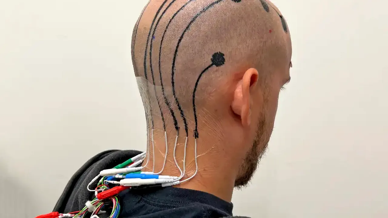 Tatuajele „electronice” de pe scalp ar putea revoluţiona monitorizarea creierului