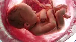 Premieră medicală: Un copil a primit tratament salvator încă din pântecul mamei