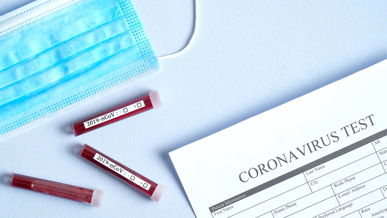 Cercetătorii au creat un kit de testare COVID prin smartphone. Preţul este mai mic decât cel al unui test PCR sau antigen
