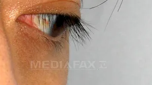 GOOGLE va lansa lentile de contact sensible la zahăr, pentru diabetici