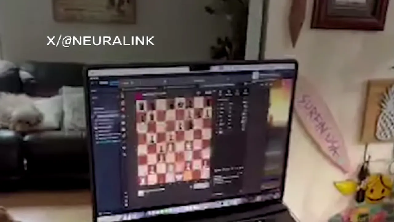 Primul pacient cu cip cerebral joacă şah online