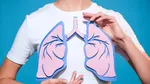 Premieră: Fibroza pulmonară tratată prin aerosoli. Cum ar putea celulele stem să schimbe viitorul bolilor pulmonare grave