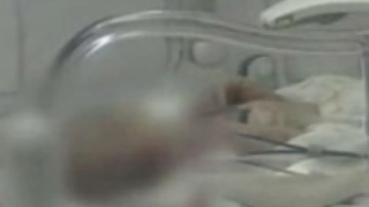 Braşov: O adolescentă de 16 ani a născut siamezi (Video)