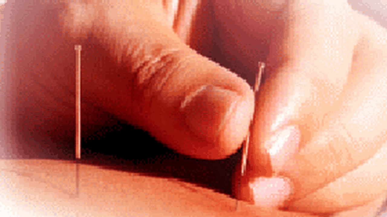 Acupunctura poate creşte rata de succes a fecundării in vitro