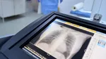 Nu este inima și nici creierul. Organul care ar putea influența longevitatea