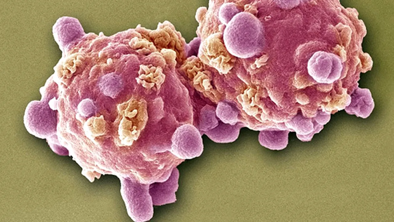 SFATURILE experţilor pentru a preveni apariţia cancerului