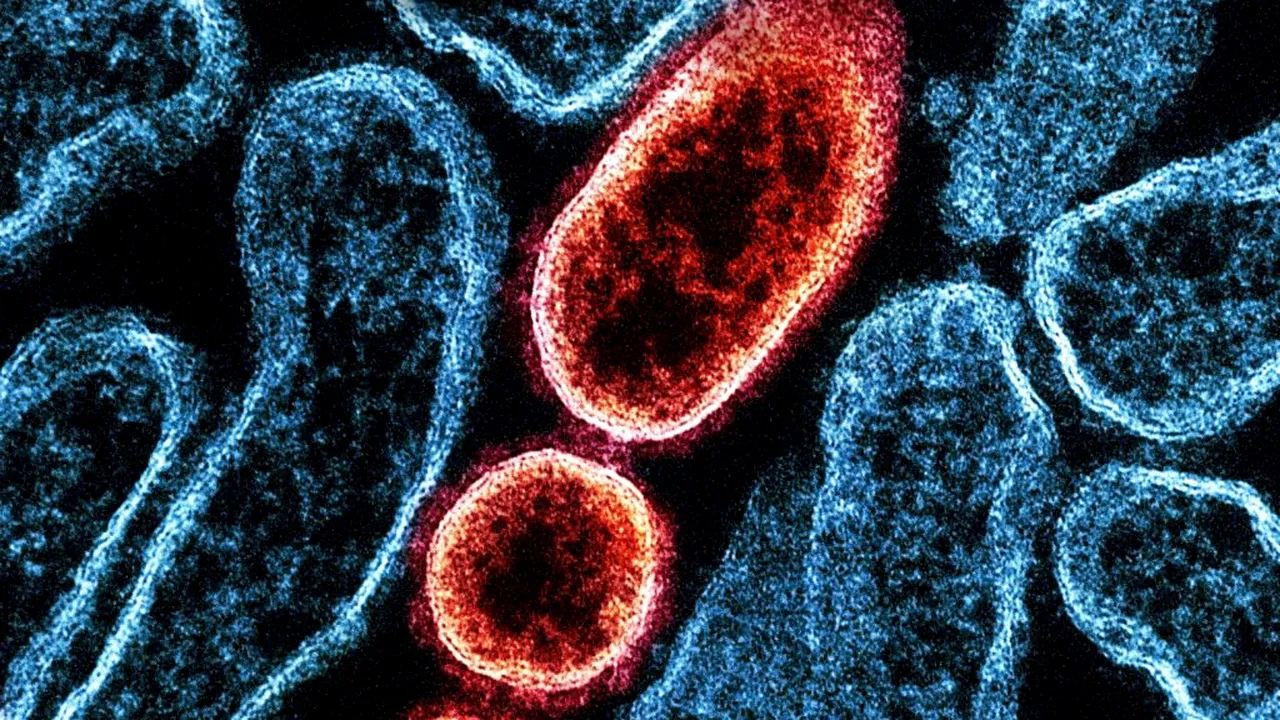 Controale amănunțite în aeroporturi din Asia după ce India anunță noi infecții cu virusul Nipah
