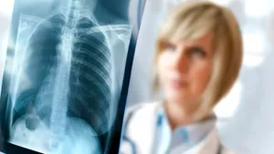 Statistici îngrijorătoare de la UNICEF: Pneumonia a ucis un copil cu vârsta sub 5 ani la fiecare 39 de secunde, în 2018. 800.000 de victime într-un singur an