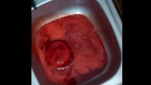 Deputatul Ungureanu face noi acuzaţii grave: Spitalele aruncă mii de litri de sânge contaminat / Unde ar ajunge substanţele periculoase