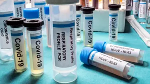 EXPERŢI OXFORD. Tratamentul care poate salva vieţile oamenilor cu forme grave de COVID-19. Medicamentul e disponibil şi în România