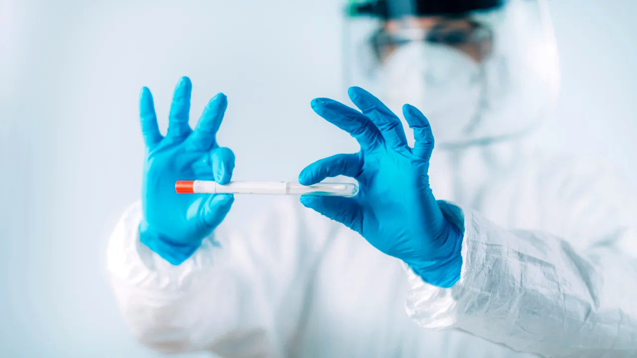Coronavirus în România 12 aprilie LIVE UPDATE. 2.323 cazuri noi de persoane infectate cu SARS–CoV–2. Situaţia de la ATI. Bilanţ actualizat COVID-19