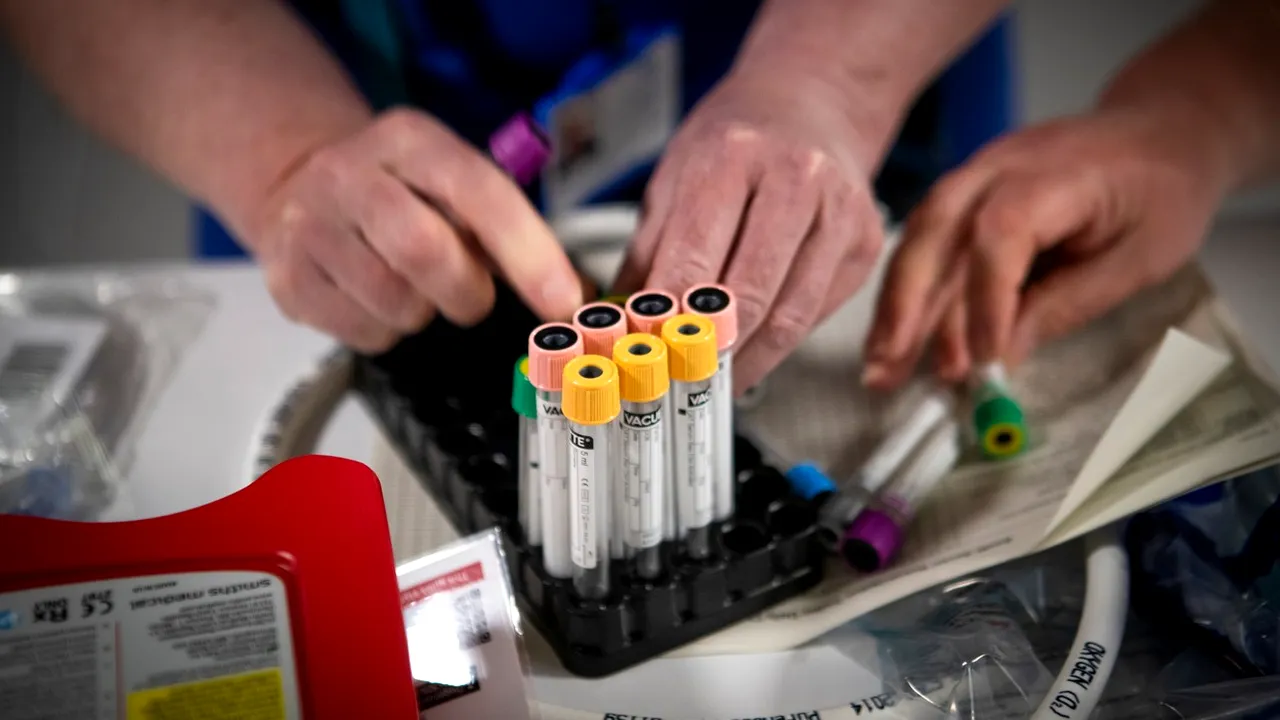 Coronavirus în lume LIVE UPDATE 20 aprilie: Spania devine a doua ţară din lume care depăşeşte 200.000 de bolnavi / Cele mai puţine cazuri noi din ultimele săptămâni în Marea Britanie