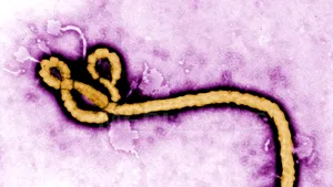 STUDIU: Virusul Ebola poate să reziste în sperma supravieţuitorilor acestei maladii pentru cel puţin 9 luni