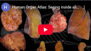 Human Organ Atlas, „Google Earth