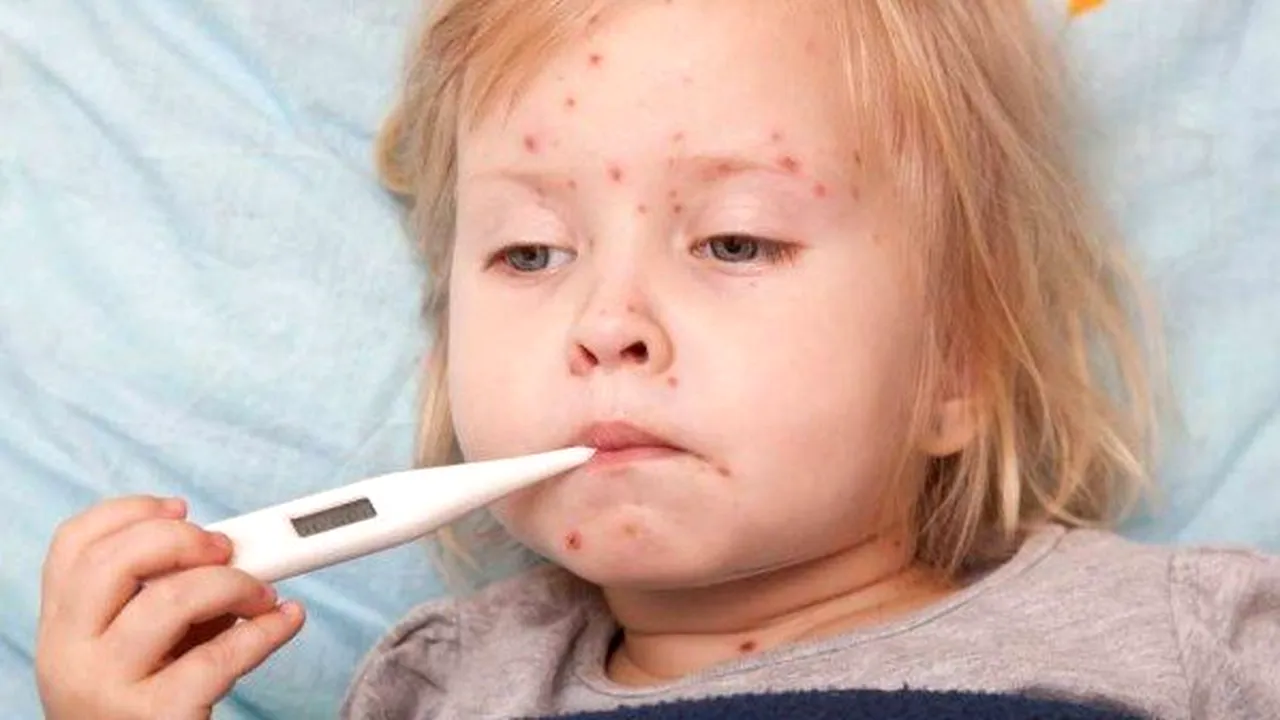 Peste 10.500 cazuri de rujeolă înregistrate, dintre care peste 10.000 sunt la persoane nevaccinate