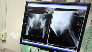 Razele X - cea mai importantă descoperire ştiinţifică a lumii moderne