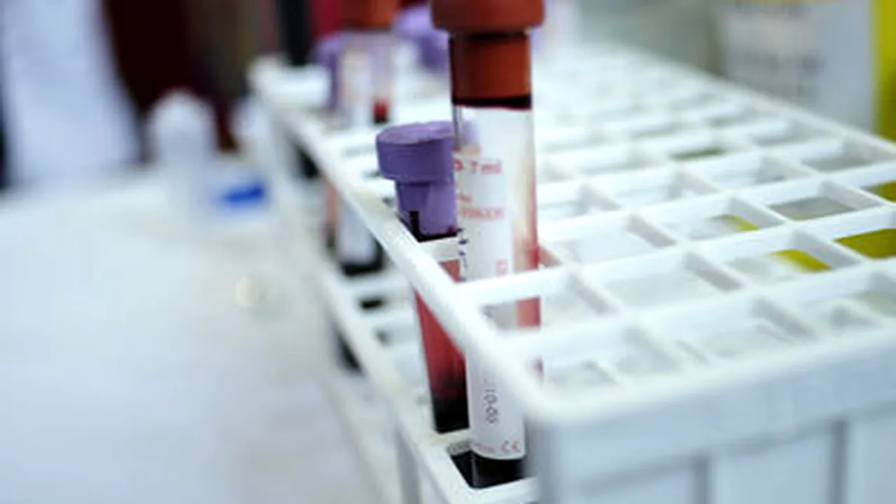 Bucharest Blood Transfusion Center Staff Protested Friday Over 30% Wage Cut