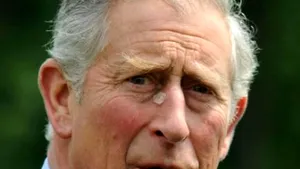 Prince Charles Has Non-Cancerous Growth Removed From Face