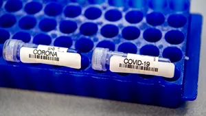 România a făcut într-o lună mai puţine teste decât face Germania într-o zi. Câte au fost prelucrate până acum