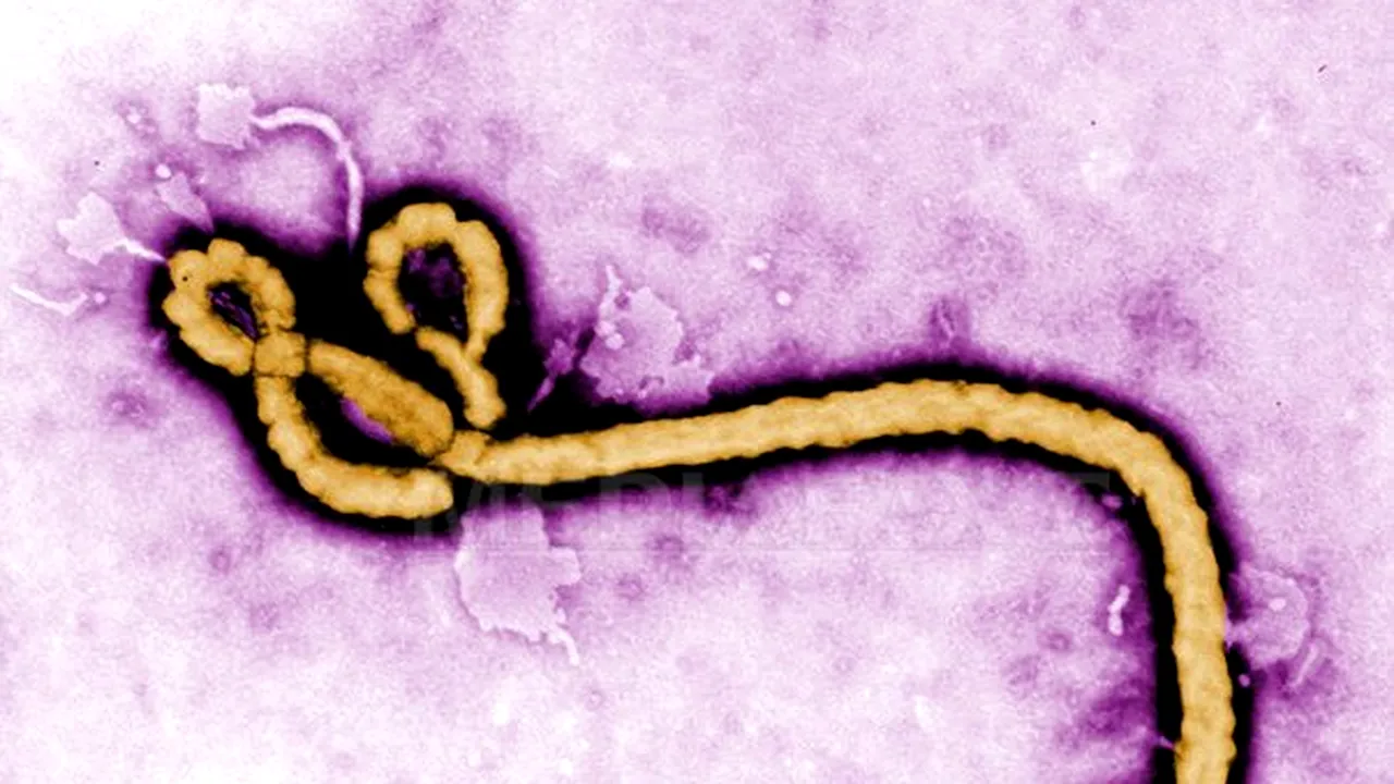 1-ebola-virus-epa 
