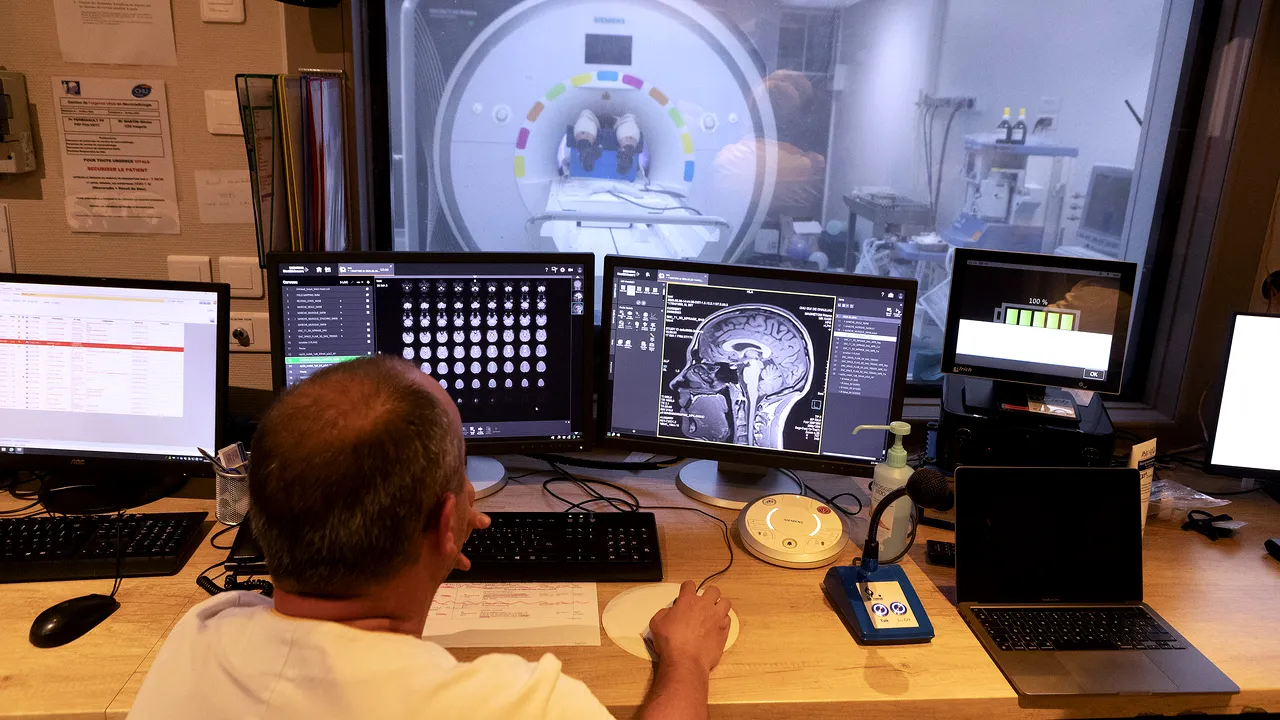 O rusoaică a trăit 80 de ani cu un ac în creier. Medicii cred că părinţii ei au încercat să o ucidă