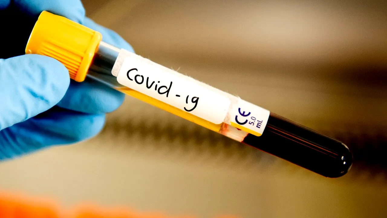 Spania returnează Chinei pentru a doua oară kituri de testeare COVID-19 defecte