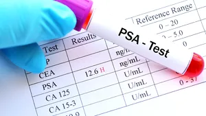 S-ar salva mii de vieţi, anual, cu testul PSA la bărbaţi (de prostată), singurul marker folosit în diagnostic