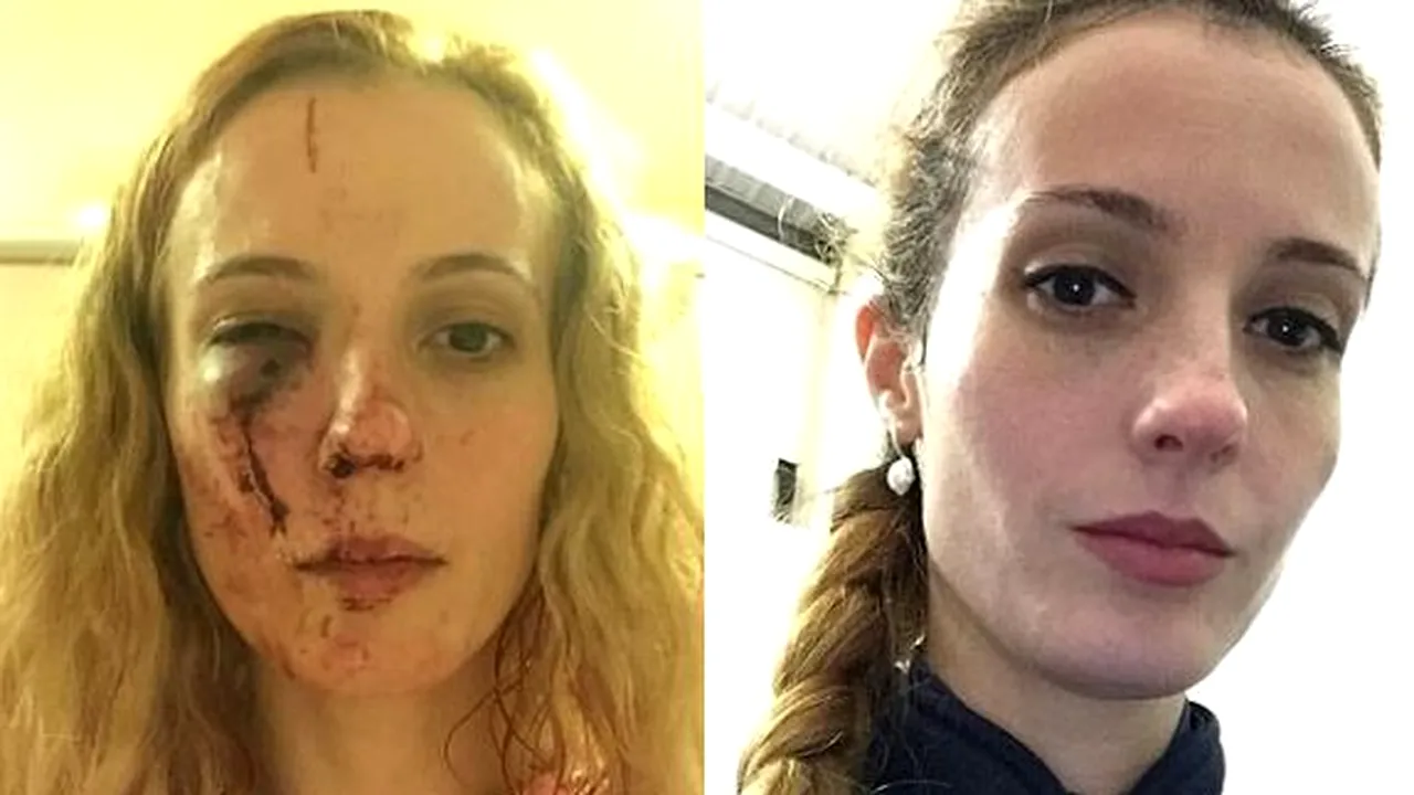 ROMÂNCĂ bătută cu bestialitate în Marea Britanie de o bandă de adolescenţi pentru că 