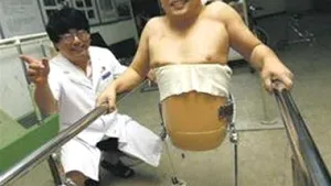 Un chinez trăieşte cu jumătate din corpul său: Este optimist şi multimilionar