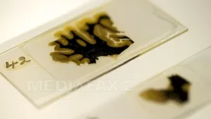 Cum a fost furat creierul lui Einstein şi pierdut timp de 50 de ani - FOTO