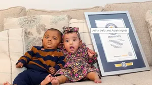 Fraţi născuţi la 22 de săptămâni, desemnaţi de Cartea Recordurilor drept cei mai prematuri gemeni din lume