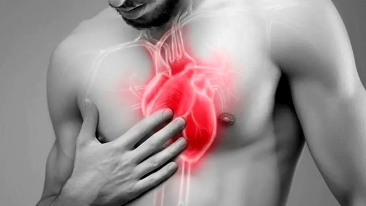 infarct 