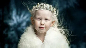 GALERIE FOTO Nariyana, fetiţa cu albinism a cărei frumuseţe întrece orice imaginaţie. Agenţiile de modelling o copleşesc cu oferte 