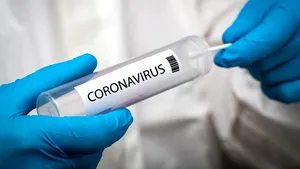 Coronavirus în lume LIVE UPDATE 26 mai: Peste 390 de cazuri noi în Italia, 78 decese. Bilanţul din ultimele 24 ore
